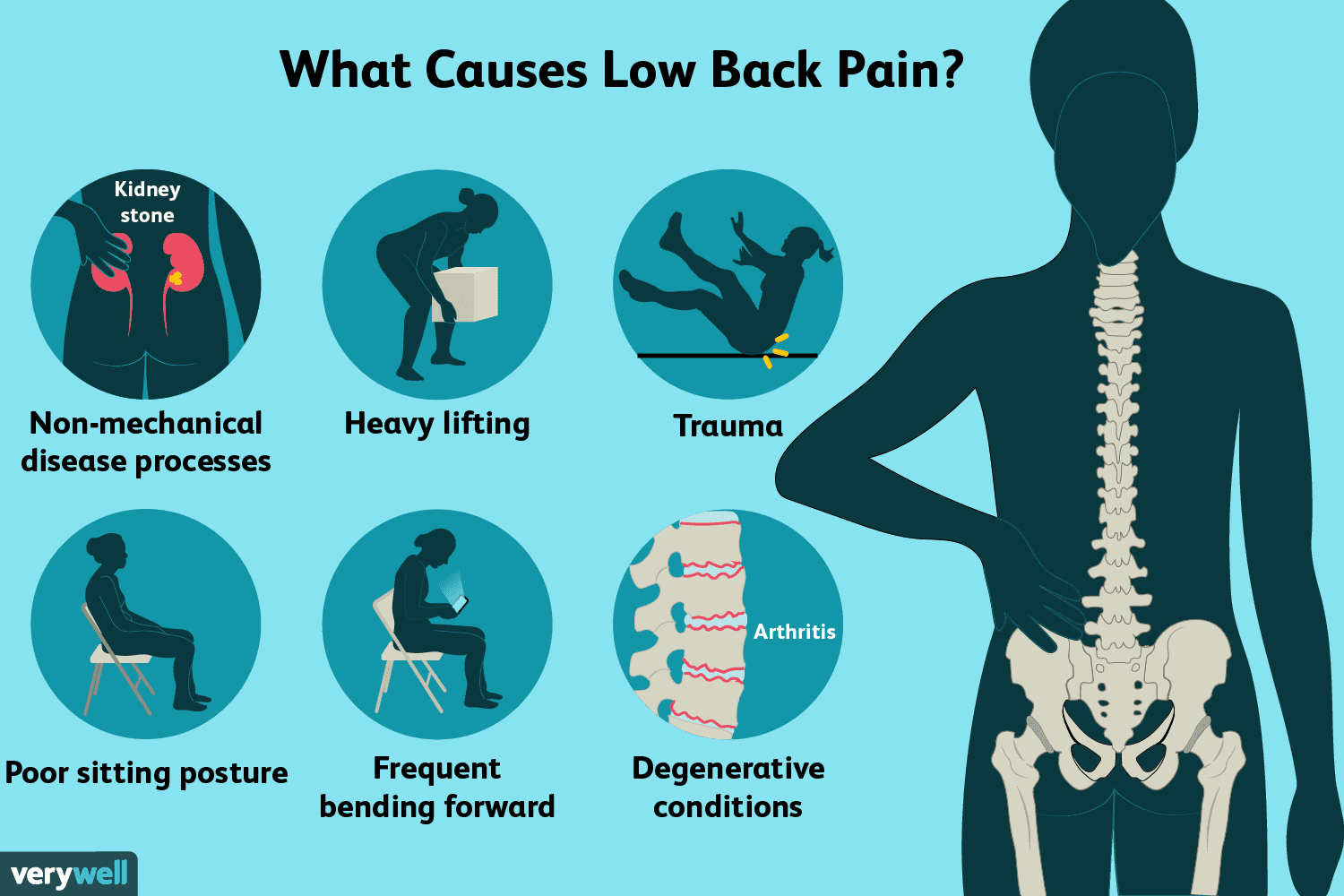 5 Amazing Back Pain Exercises You'll Love