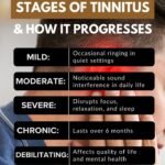 Stages of Tinnitus & How It Progresses Over Time 1